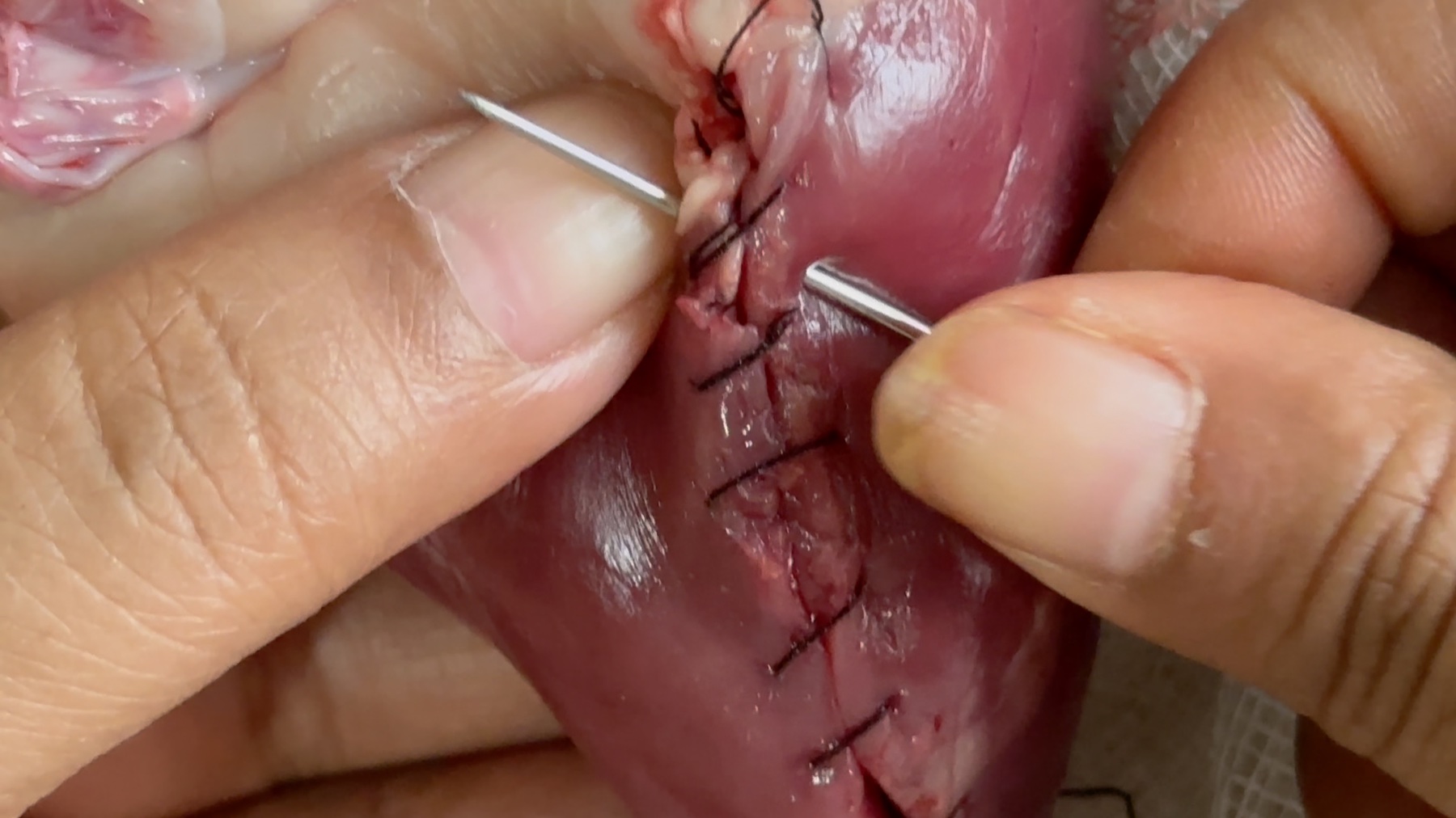 Hands stitching a wound, a close study of mending